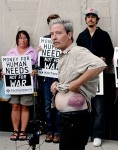 Mick Kelly says he was bruised by police while protesting at the RNC in 2008. I see Jesus in that bruise. How about you?